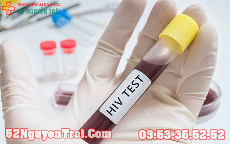 test-nhanh-HIV-Ag-Ab-combo-chinh-xac-khong