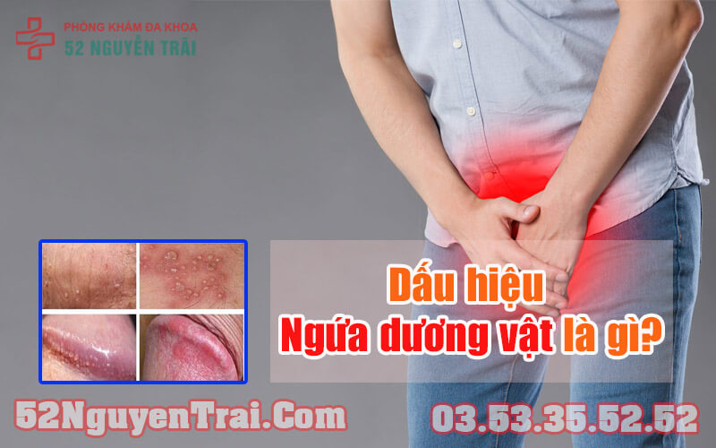 Bị ngứa dương vật uống thuốc gì 1