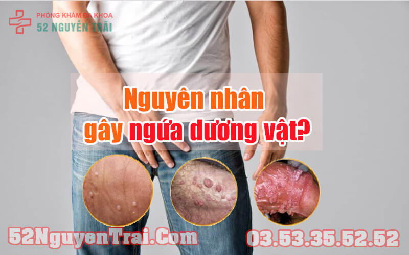 Bị ngứa dương vật uống thuốc gì