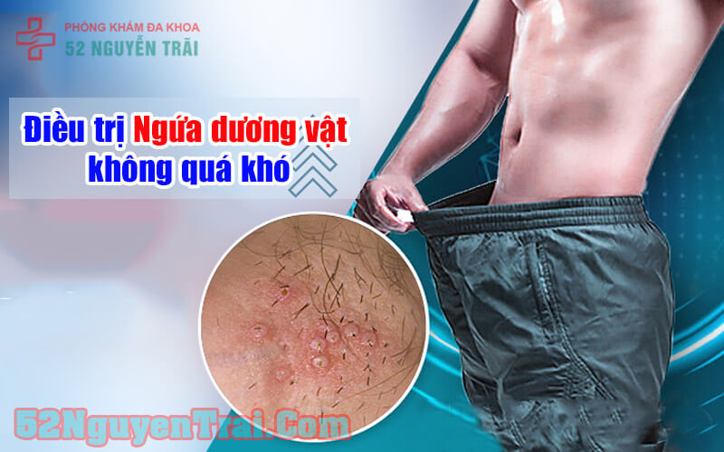 Ngứa dương vật nguyên nhân 2