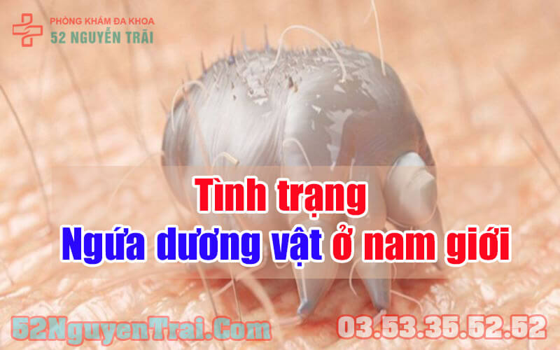 Ngứa dương vật nguyên nhân