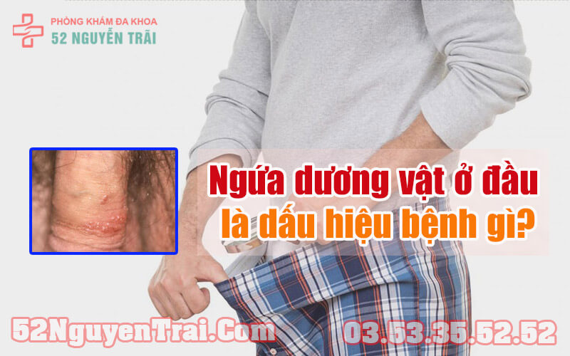 Ngứa dương vật ở đầu 1