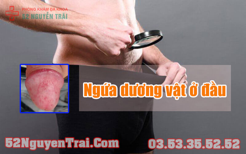 Ngứa dương vật ở đầu