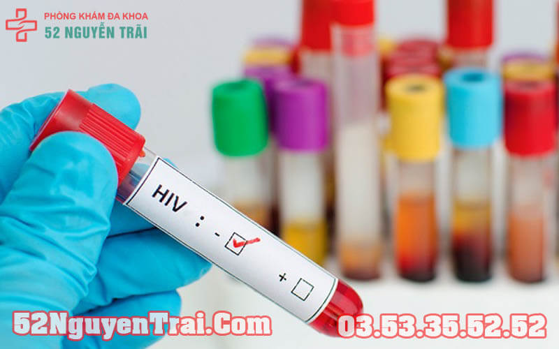 xet-nghiem-chuan-doan-hiv-aid-52nguyentrai