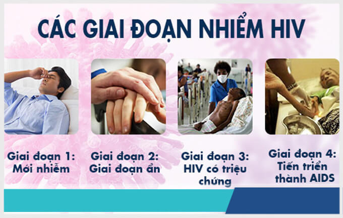 AIDS Nhiễm HIV tiến triển