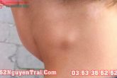 Hiv nổi hạch ở đâu?