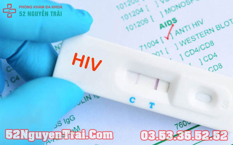 Xét nghiệm HIV âm tính là gì?