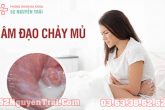 Chảy mủ ở vùng kín nữ giới: Dấu hiệu bệnh phụ khoa gây vô sinh