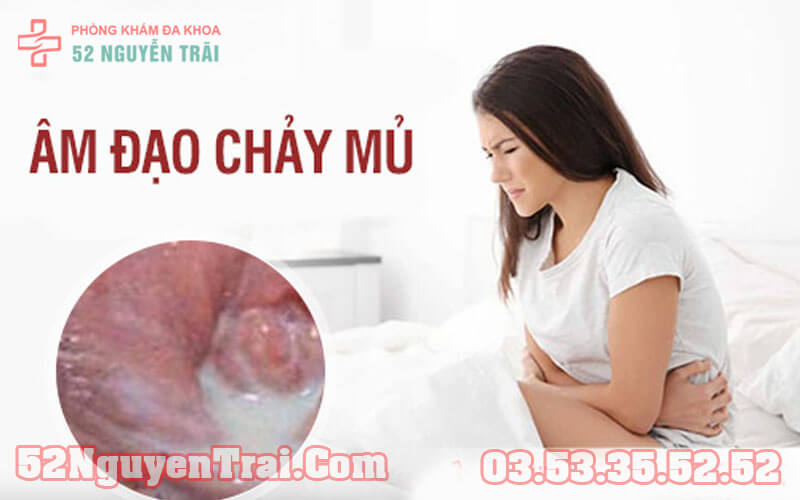 chay-mu-vung-kin