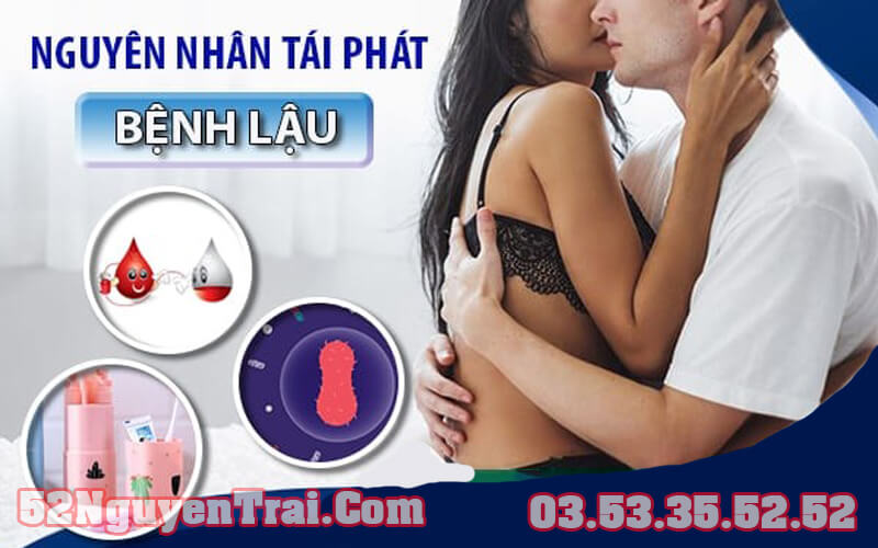 Bệnh lậu tái phát 1