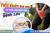 Biểu hiện của bệnh lậu