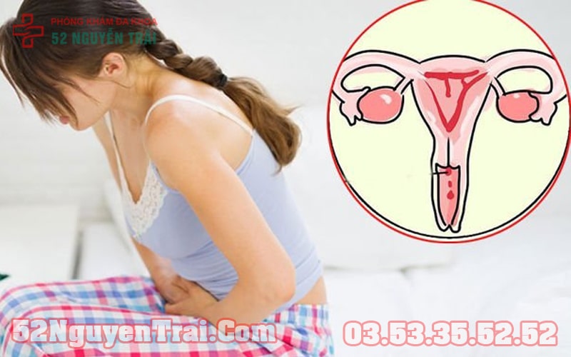 Chảy mủ vùng kín 2