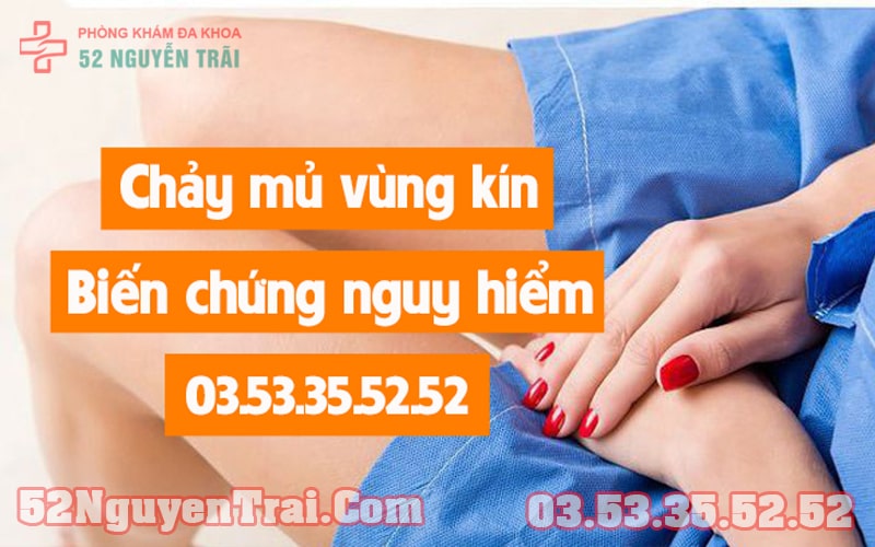 Chảy mủ vùng kín 4