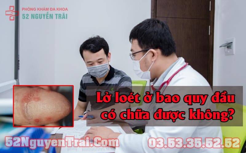 Loét bao quy đầu 7