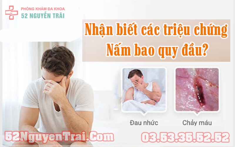 Nấm bao quy đầu 1