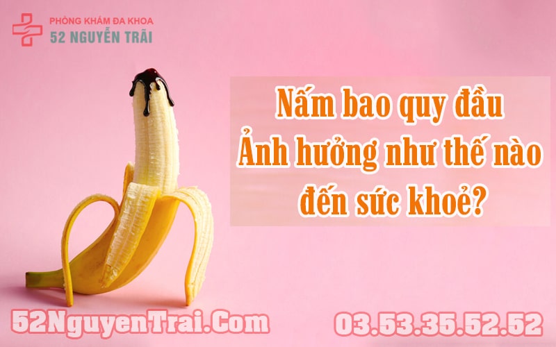 Nấm bao quy đầu 2