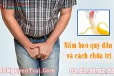 Nấm bao quy đầu và cách chữa trị