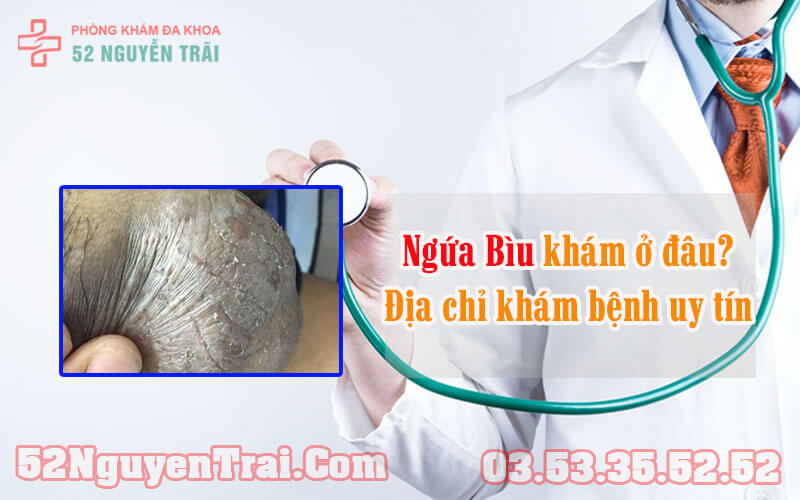 Ngứa bìu khám ở đâu 2