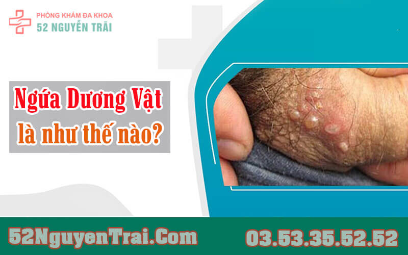 Ngứa dương vật kiêng ăn gì