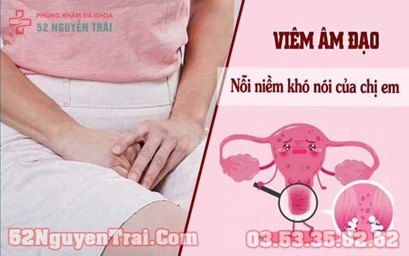 Ra mủ ở vùng kín 4