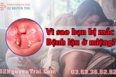 Thời gian ủ bệnh lậu ở miệng