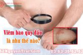Viêm bao quy đầu