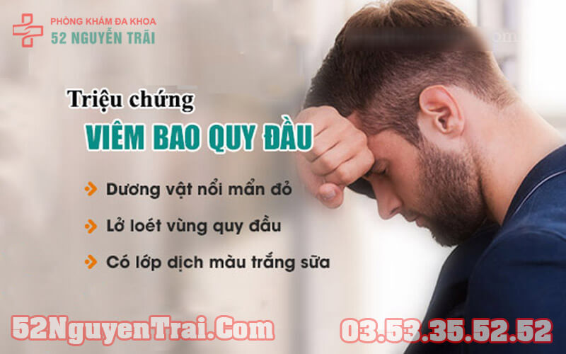 Viêm bao quy đầu 2