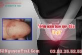 Viêm nấm bao quy đầu