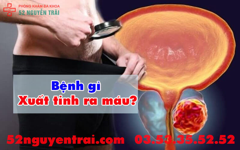 Bệnh gì xuất tinh ra máu