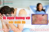 Bị ngứa dương vật nổi mẩn đỏ