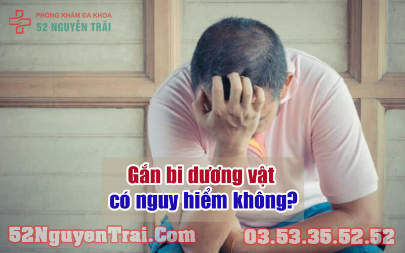 Gắn bi dương vật có nguy hiểm không?