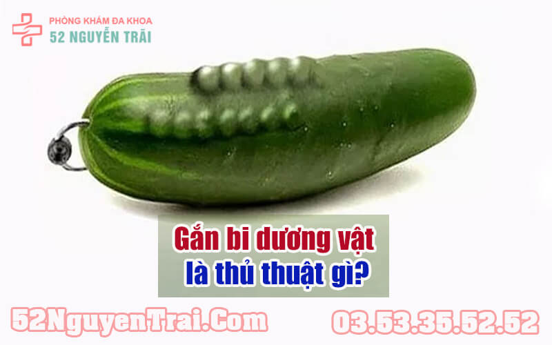 Gắn bi dương vật có nguy hiểm không