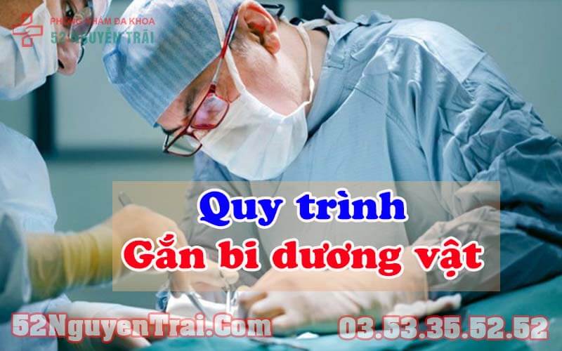 Gắn bi dương vật có tốt không 2