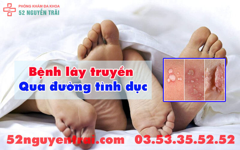 Ngứa bìu có vảy trắng 1