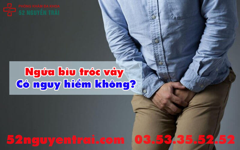 Ngứa bìu tróc vảy 2