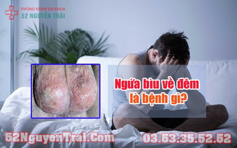 Ngứa bìu về đêm 2