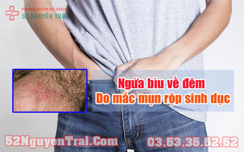 Ngứa bìu về đêm 3