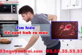 Tìm hiểu về xuất tinh ra máu
