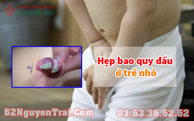 Trẻ em bị ngứa dương vật 1