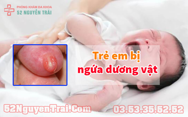 Trẻ em bị ngứa dương vật