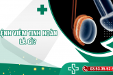 Bệnh viêm tinh hoàn