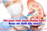 Mổ giãn tĩnh mạch thừng tinh